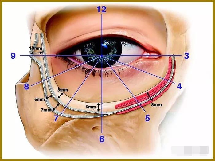 结膜入路松解泪沟韧带和重置脂肪的扩大下睑成形术(二)