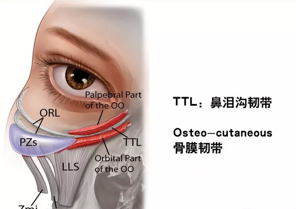 ttl: tear trough ligament鼻泪沟韧带对鼻泪沟韧带的存在是不必存疑