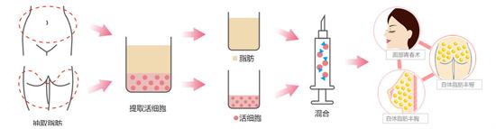 u=3046764944,3977674646&fm=27&gp=0.jpg