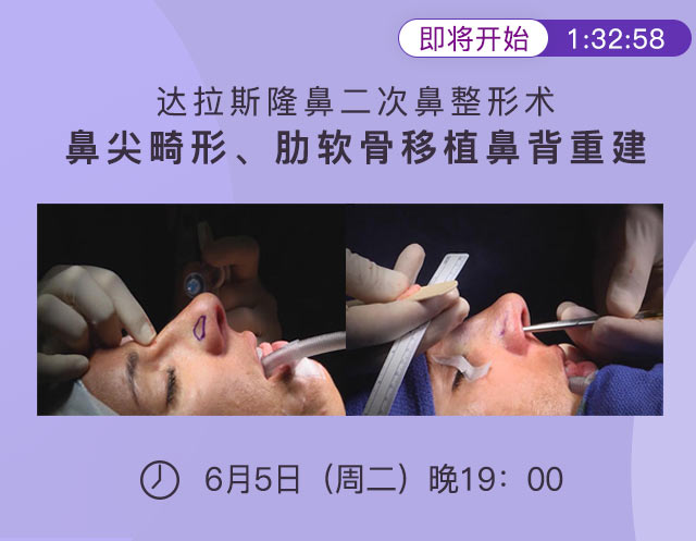 即将开始2.jpg