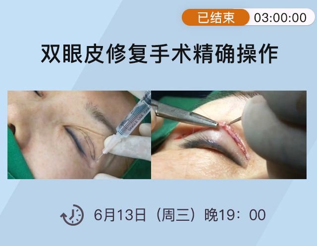 结束.jpg